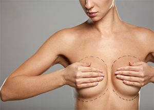 sydney-breast-augmentation-cost