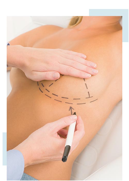 Removal of Breast Fat