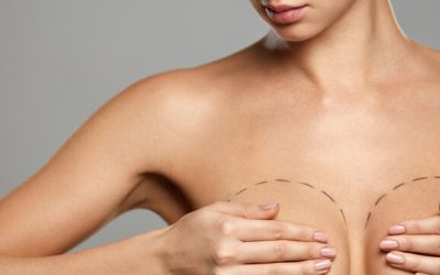 How to Handle Swelling After Breast Augmentation – Consider These Tips To Follow