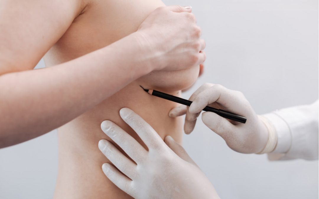 botched boob job